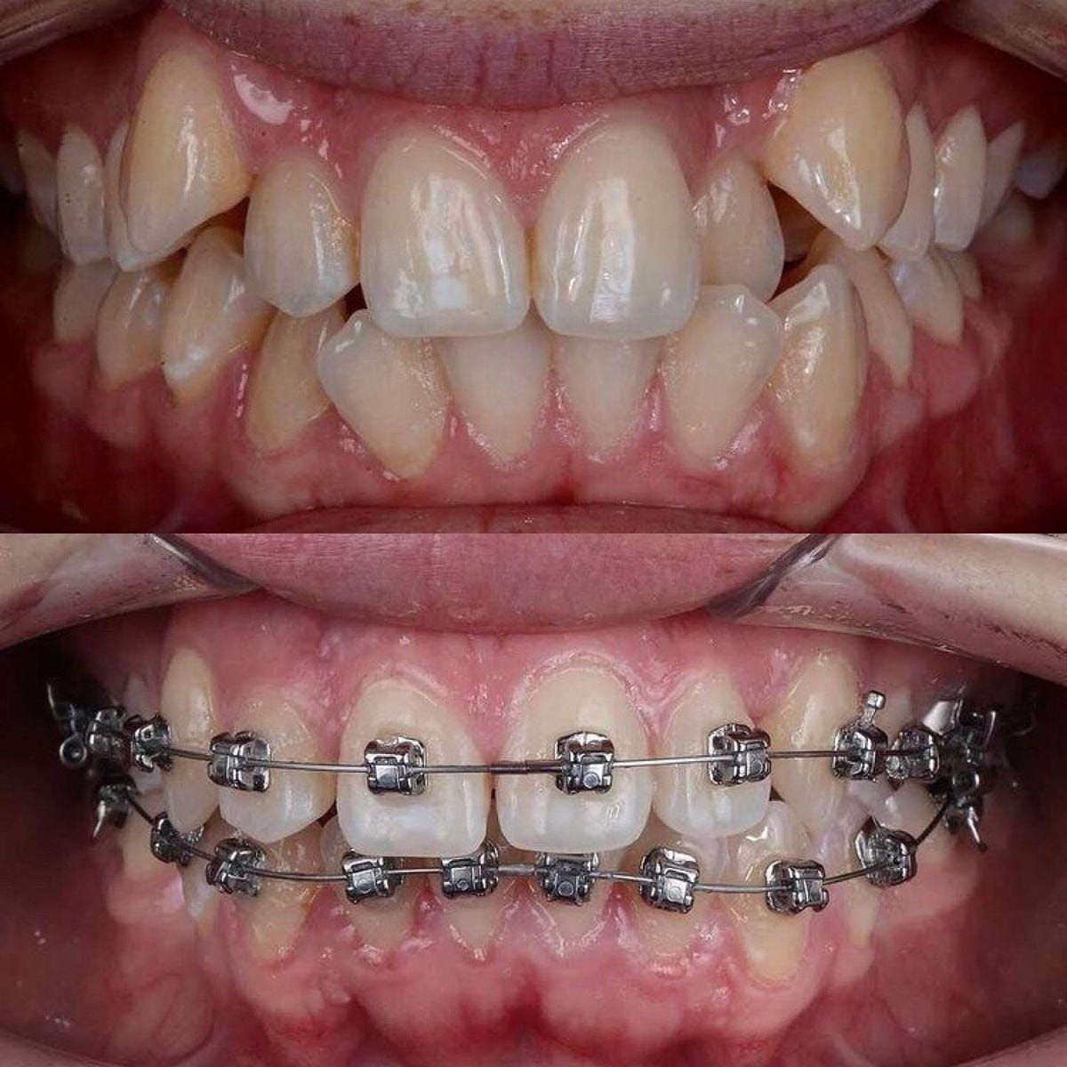 डॉ. राजेंद्र गोडे मेडिकल कॉलेज व हॉस्पिटल: मरीजों के लिए विश्वसनीय चिकित्सा केंद्र।